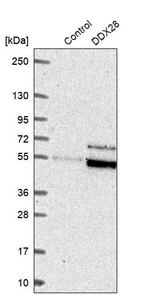 DDX28 Antibody in Western Blot (WB)