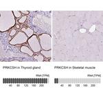 PRKCSH Antibody in Immunohistochemistry (IHC)