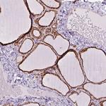 PRKCSH Antibody in Immunohistochemistry (IHC)