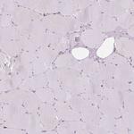 PRKCSH Antibody in Immunohistochemistry (IHC)