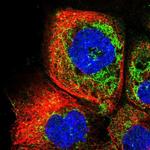 RDH13 Antibody in Immunocytochemistry (ICC/IF)