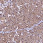 CHMP2A Antibody in Immunohistochemistry (IHC)