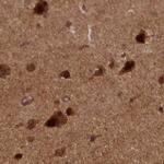 NAE1 Antibody in Immunohistochemistry (IHC)