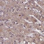 NAE1 Antibody in Immunohistochemistry (IHC)