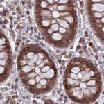 NAE1 Antibody in Immunohistochemistry (IHC)