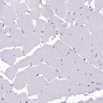 SOD3 Antibody in Immunohistochemistry (IHC)