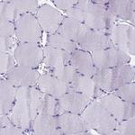 KCTD14 Antibody in Immunohistochemistry (IHC)