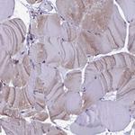 CIAPIN1 Antibody in Immunohistochemistry (IHC)