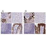 HSD11B2 Antibody in Immunohistochemistry (IHC)