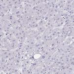 HSD11B2 Antibody in Immunohistochemistry (IHC)