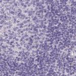 HSD11B2 Antibody in Immunohistochemistry (IHC)