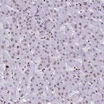 Histone H4 Antibody in Immunohistochemistry (IHC)