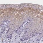 MVB12A Antibody in Immunohistochemistry (IHC)