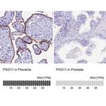 PSG11 Antibody in Immunohistochemistry (IHC)