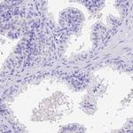 PSG11 Antibody in Immunohistochemistry (IHC)