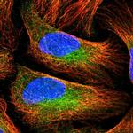 PAM Antibody in Immunocytochemistry (ICC/IF)