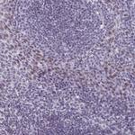 ASH2L Antibody in Immunohistochemistry (IHC)