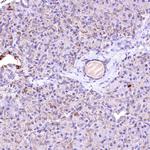 ACAA2 Antibody in Immunohistochemistry (IHC)