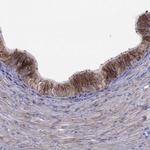 B4GALT7 Antibody in Immunohistochemistry (IHC)