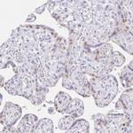 VGLL1 Antibody in Immunohistochemistry (IHC)