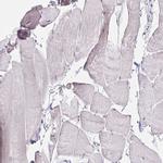 VGLL1 Antibody in Immunohistochemistry (IHC)