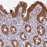 C21orf7 Antibody in Immunohistochemistry (IHC)