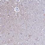 UNC80 Antibody in Immunohistochemistry (IHC)