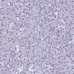 UNC80 Antibody in Immunohistochemistry (IHC)