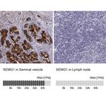 SEMG1 Antibody in Immunohistochemistry (IHC)