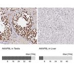 AKAP8L Antibody in Immunohistochemistry (IHC)