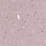 CCDC114 Antibody in Immunohistochemistry (IHC)