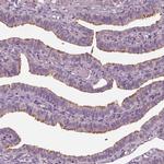 CCDC114 Antibody in Immunohistochemistry (IHC)