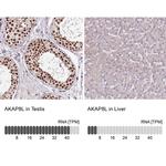 AKAP8L Antibody in Immunohistochemistry (IHC)