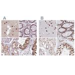 AKAP8L Antibody in Immunohistochemistry (IHC)