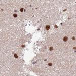 AKAP8L Antibody in Immunohistochemistry (IHC)