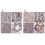 HDGFRP2 Antibody in Immunohistochemistry (IHC)