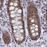 HDGFRP2 Antibody in Immunohistochemistry (IHC)