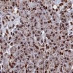 HDGFRP2 Antibody in Immunohistochemistry (IHC)