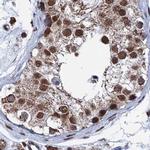 HDGFRP2 Antibody in Immunohistochemistry (IHC)