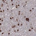 HDGFRP2 Antibody in Immunohistochemistry (IHC)