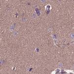 DUS2L Antibody in Immunohistochemistry (IHC)