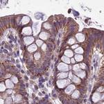 DUS2L Antibody in Immunohistochemistry (IHC)