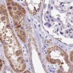 DUS2L Antibody in Immunohistochemistry (IHC)