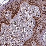 Histone H3.3 Antibody in Immunohistochemistry (IHC)