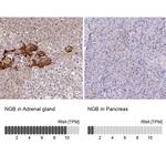 NGB Antibody in Immunohistochemistry (IHC)