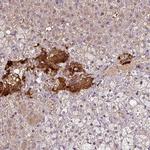 NGB Antibody in Immunohistochemistry (IHC)