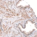 SMC6 Antibody in Immunohistochemistry (IHC)