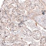 SMC6 Antibody in Immunohistochemistry (IHC)