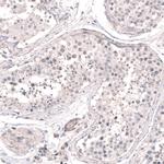 SMC6 Antibody in Immunohistochemistry (IHC)