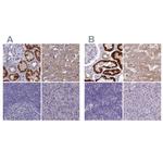 Adenylate Kinase 4 Antibody in Immunohistochemistry (IHC)